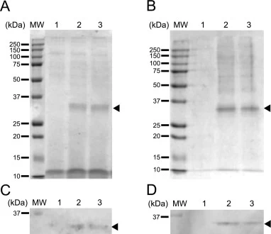 Recombinant scFv-6009FV analysis from P. pastoris culture supernatants. 12 % SDS-PAGE of recombinant scFv-6009FV expressed in A) BMMY media, and B) BMM media. Immunodetection by WB using an antibody anti-His expressed in C) BMMY media, and D) BMM media. Lane 1, control; lanes 2 and 3, total protein
