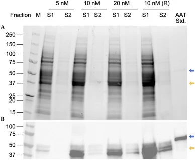 Effect of plasmid concentration (nanomolar, nM) and extraction conditions (S1:before detergent solubilization and S2:after detergent solubilization) on AAT yield as visualized on SDS-PAGE (A) and Western Blot (B). 8 μL of Precision Plus All Blue and Precision Plus All Blue Unstained were used as the