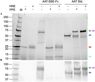 Testing functionality of ALiCE® produced AAT-SSE-Fc using Band shift assay as visualized on SDS-PAGE (A) and Western Blot (B). 8 μL of Precision Plus All Blue and Precision Plus All Blue Unstained were used as the molecular weight marker (M). Prolastin-C used as AAT Std. 1 μg of all AAT and elastase