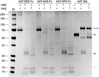 Band-shift assay of all AAT-Fc variants and AAT Std. (Prolastin-C) at 3:1 ratio with elastase as visualized by Coomassie stained gel under reducing condition. 8 μL of Precision Plus All Blue and Precision Plus All Blue Unstained were used as the molecular weight marker (M). Prolastin-C used as AAT S