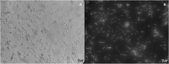 Fluorescence image microscopy of Y. lipolytica S11070 cells after Nile Red staining according to the protocol as described in material & methods. (A) shows a brightfield microscopic image without the application of a filter, (B) shows the same image with a fluorescent filter with a passband between