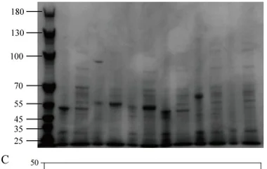 枯草芽孢杆菌中通过调控元件优化表达果聚糖蔗糖酶实现乳蔗糖高产