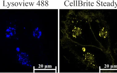 Cellular localization of CTXA8-Cy5 in U251-MG cells by confocal microscopy. U251-MG cells were treated with 0.5 µM CTXA8