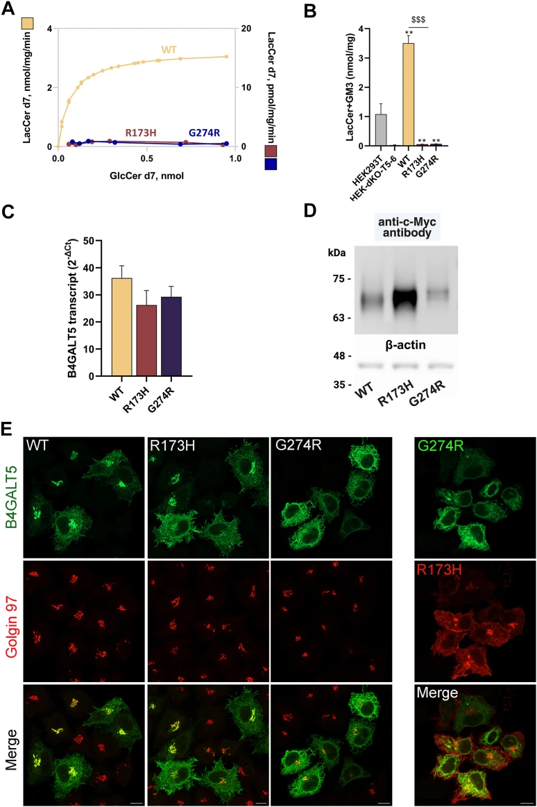 Characterization of B4GALT5 variants. A: HEK-dKO-T5-6 cells were transfected with WT B4GALT5 or patient variants (R173H and G274R) cloned in a pCDNA3 vector, and the homogenates of transfected cells were used as the enzyme source in LacCer synthase assay, as described in Figure 2 . Note the two diff