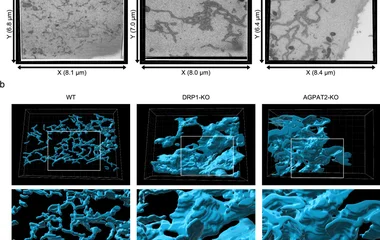 图a：WT细胞成像块尺寸8.1×6.8×0.4 µm，DRP1-KO为8.0×7.0×0.5 µm，AGPAT2-KO为8.4×6.4×0.5 µm。图b：展示对齐重建的3D图像，框选区域放大。