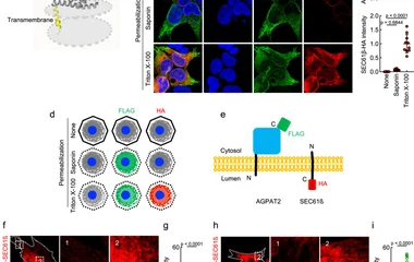 a A structure of ER membrane-embedded AGPAT2 predicted by TmAlphaFold is presented. b WT MEFs expressing AGPAT2-FLAG and