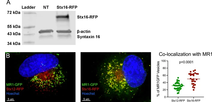 Stx12 and Stx16 co-localize with MR1 vesicles. A ) Western blot of Stx16, beta actin, and Stx16-RFP in non-transfected control (NT) and Stx16-RFP transfected BEAS-2B: TET-MR1GFP LV cells. Representative of n = 2 independent experiments. B ) Stx12-RFP (left) and Stx16-RFP (center) transfected BEAS-2B
