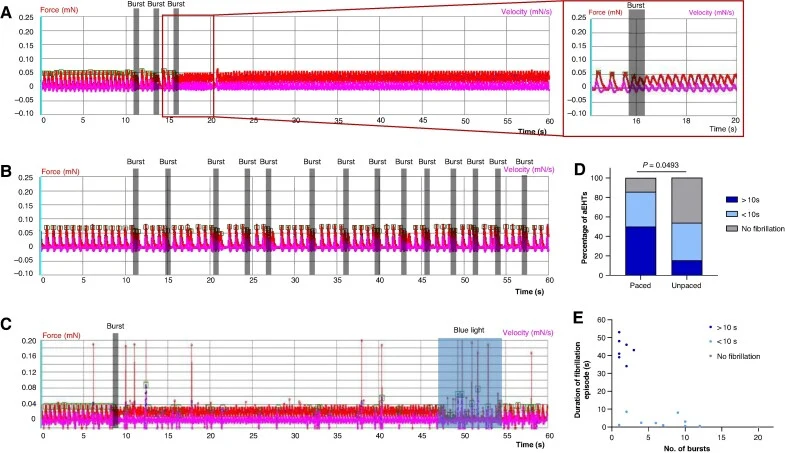 Electrical burst pacing of aEHTs. ( A–C ) Exemplary original recording traces of aEHTs during electrical burst pacing. ( A ) Optogenetically paced aEHT trace. Burst pacing was applied three times. Note fibrillation-like pattern after the third burst, with higher beating frequency and decreased contr