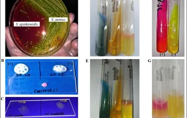Biochemical identification of Staphylococcus . The colony morphology of S. aureus and S. epidermidis is shown in (A). Bo