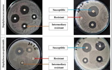 Antibiogram susceptibility pattern of S. aureus (upper) and S. epidermidis (lower) and. The zone of inhibition was measu