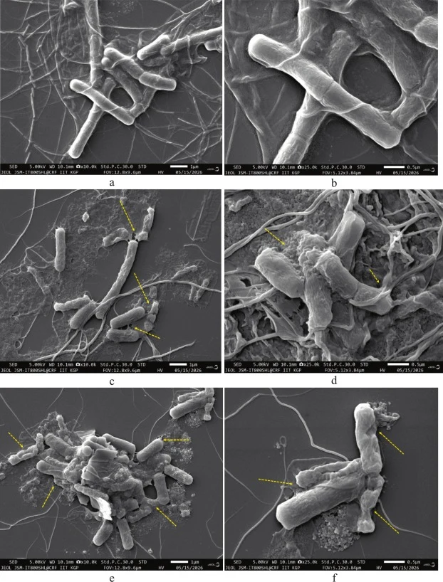 The morphology of Bacillus subtilis cells observed in SEM treated at different voltages (a) Control (10kX), (b) Control (25kX), (c) 10 kV (10kX), (d) 10 kV (25kX), (e) 15 kV (10kX), (f) 15 kV (25kX), (g) 20 kV (10kX), (h) 20 kV (25kX). The lines indicates the damage caused by plasma species to the B