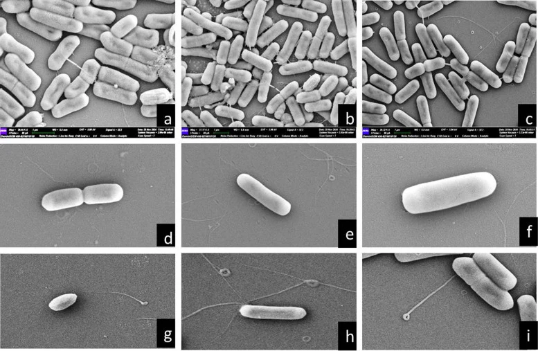 SEM of three LJRB strains: a LJRB1 at 39.44 KX; b LJRB2 at 27.17 KX; c LJRB3 at 28.32 KX, Single bacterium representation of ligninolytic bacterial strains: d LJRB1 at 34.87 KX; e LJRB2 at 30.78 KX; f LJRB3 at 55.10 KX. SEM micrographs revealed the presence of hair-like appendages (flagella), sugges