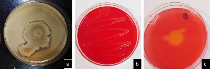 Screening for pectin, Xylan & Cellulose degrading properties of the ligninolytic isolates. a Pectin Agar plates showed no (or negligible) hydrolyzed zone for any isolate after flooding the grown (on Pectin Agar Media by spot plate method) colony with 2% Cetrimide, which indicates that the LJRBs