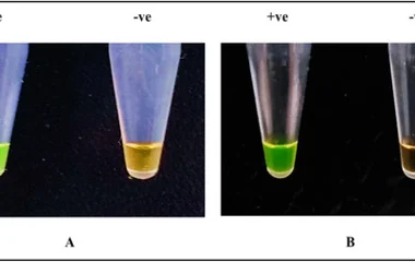 基于LAMP-CRISPR/Cas12a的炭疽芽孢杆菌孢子检测平台