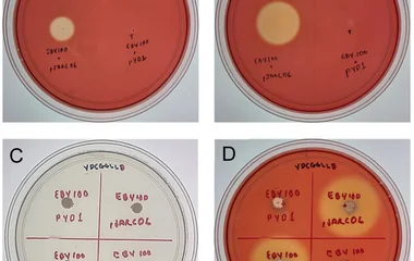 Cellulase activity assay of Saccharomyces cerevisiae strains on YNB agar plates supplemented with 1% ( w / v ) carboxyme
