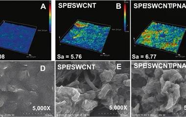 基于PNA/SWCNT与机器学习的蜡样芽孢杆菌定量检测