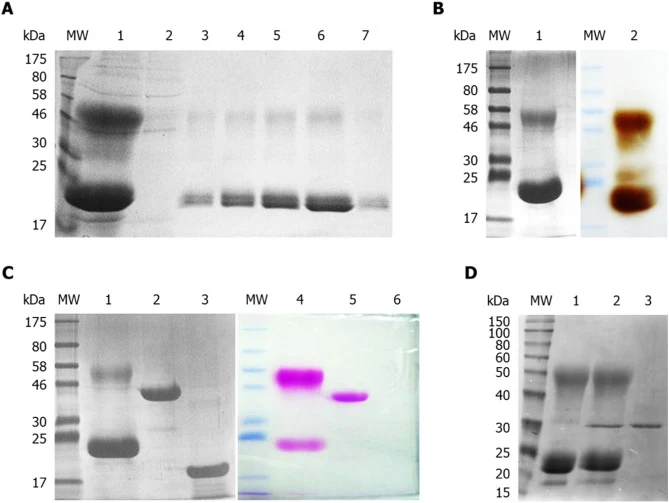 SDS-PAGE, glycoprotein staining, zymography and deglycosylation of AnCUT3. (A) SDS-PAGE profile of cutinase from fractions of affinity chromatography purification. MW: Molecular weight marker; 1: Crude concentrated enzyme; 2: Unbound fraction; 3 to 7: Fractions with purified cutinase. (B) Protein pr