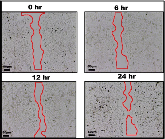 PC3 cells treated with 50 μg/mL were wounded and monitored over 24 h at 6 h intervals. Wound closure increased progressively, reaching 13.38 ± 0.48% at 6 h, 33.65 ± 0.85% at 12 h, and 69.76 ± 0.86% at 24 h. Values are expressed as mean ± SD (n = 3). A clear wound gap was observed at 0 h in a conflue