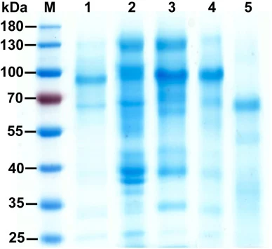 通过12% SDS-PAGE对酶解提取物MPE和LPE进行蛋白质组学分析。蛋白图谱显示,泳道1为粗提物MPE,泳道2为对应的MPCE截留组分。泳道3和4分别展示粗提物LPE和LPCE截留组分。泳道5突出显示了ch……