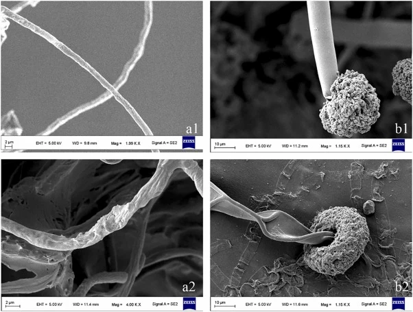 Scanning electron microscopy images of Aspergillus niger S15 morphology after 3-MA treatment. (a1, a2: hyphal morphology; b1, b2: conidial morphology; a1 and b1: control; a2 and b2: 3-MA treated group).