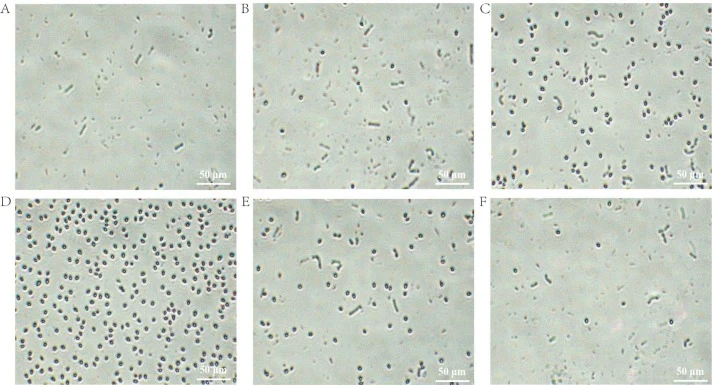 Phase-contrast microscopy images of Bacillus cereus cultured under sporulation conditions at 10, 18, 25, 30, 37, and 40 °C. Spores were produced at (A) 10 °C, (B) 18 °C, (C) 25 °C, (D) 30 °C, (E) 37 °C, and (F) 40 °C. Representative microscopy images were obtained from three independent biological r