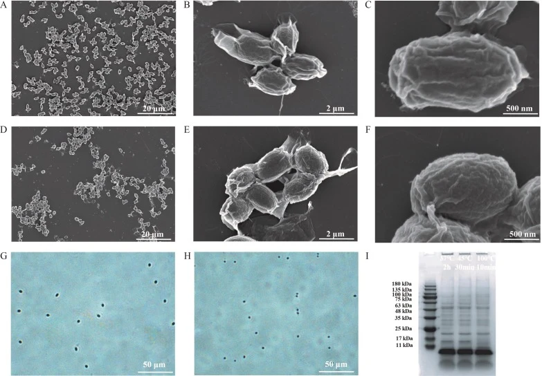Verification of inner membrane exposure and extraction of spore inner membrane proteins (IMPs). A-C. electron microscopy characterization of untreated spores; DF. electron microscopy characterization of inner membrane-exposed treated spores; G. phase-contrast microscopy characterization of untreated