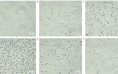 蜡样芽孢杆菌孢子的温度依赖性：产孢、萌发行为及内膜蛋白响应