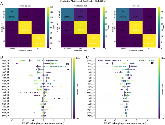 Classification consistency and stage-specific interpretability of the LightGBM multiclass model. (A) Confusion matrices of the LightGBM model on the training, validation, and held-out test subsets. (B) SHAP summary plot showing the top contributing features for discrimination of the D2 class. (C) SH
