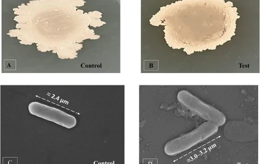 海洋大型藻内生菌枯草芽孢杆菌ULB16可持续砷生物修复研究