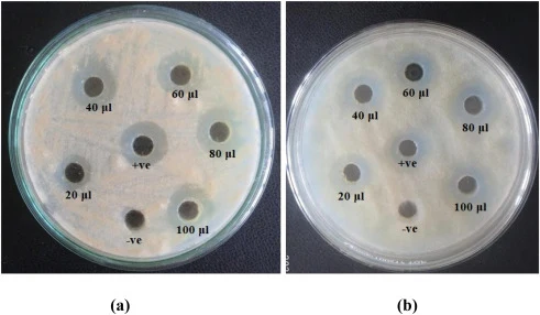 Crude enzyme extract antifungal activity against (a) Fusarium sp. (b) Mucor sp.