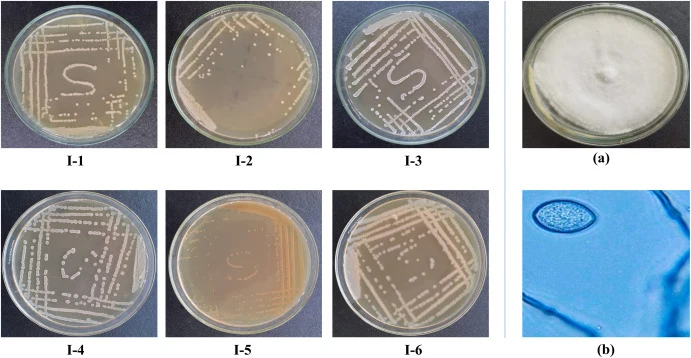 Isolation of bacterial and fungal isolates on the left. Pure culture plates of six morphologically distinct bacterial isolates were obtained after repeated sub-culturing on LB agar. Isolation and identification of the oomycete pathogen on the right. (a) Pure fungal culture on PDA after 14 days at 25