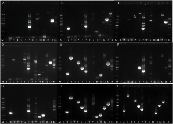 Detection of virulence genes in clinical K. pneumoniae isolates by PCR. Lane M represents DNA Marker II, band sizes from top to bottom are 1500, 900, 700, 500, 400, 200, 100 bp; letters A–I correspond to different strains: A: 76, B: 77, C: 111, D: 113, E: K11, F: S469, G: YB43, H: YB47, I: JB22; Lan