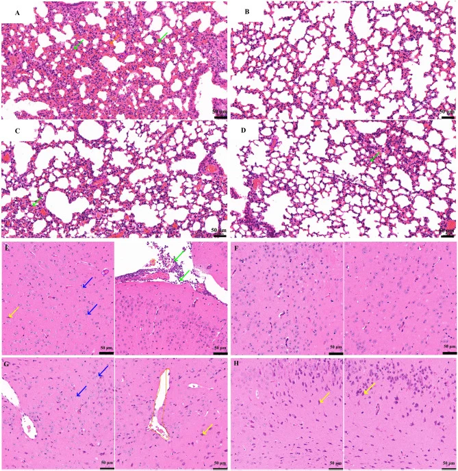 Protective effects of N6 on lung and brain tissues in K. pneumoniae-infected mice (Histological Observation, HE Staining). (A–D): Histopathological sections of lung tissue (A): Infected Group: Prominent neutrophil infiltration in alveolar walls (green arrows); scattered necrotic cell debris in alveo