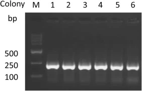 Verification of CYP7A1 expression plasmids by colony PCR. Colony PCR products from E. coli transformants harboring recombinant plasmids encoding truncated human CYP7A1. Lanes 1–6: positive colonies showing the expected amplicon size of 213 bp (Lanes 1 and 2: pET-17b-tCYP7A1-fCPR; Lanes 3 and 4: pET-