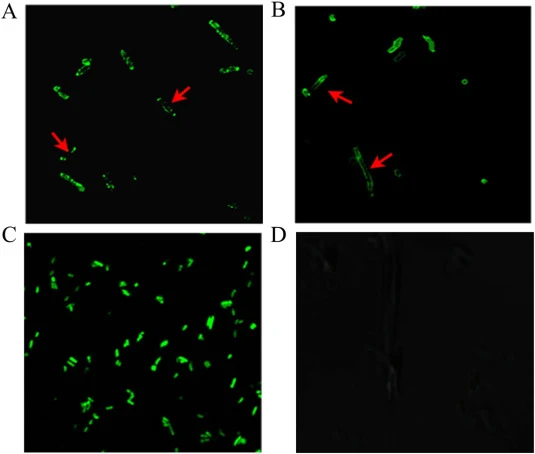 Subcellular localization of BsMenA in E. coli cells determined by EGFP fusion fluorescence microscopy. Both N-terminal (A) and C-terminal (B) fusion constructs exhibited membrane-associated fluorescence, confirming correct membrane localization of BsMenA. (C) Cells expressing EGFP showed uniform cyt